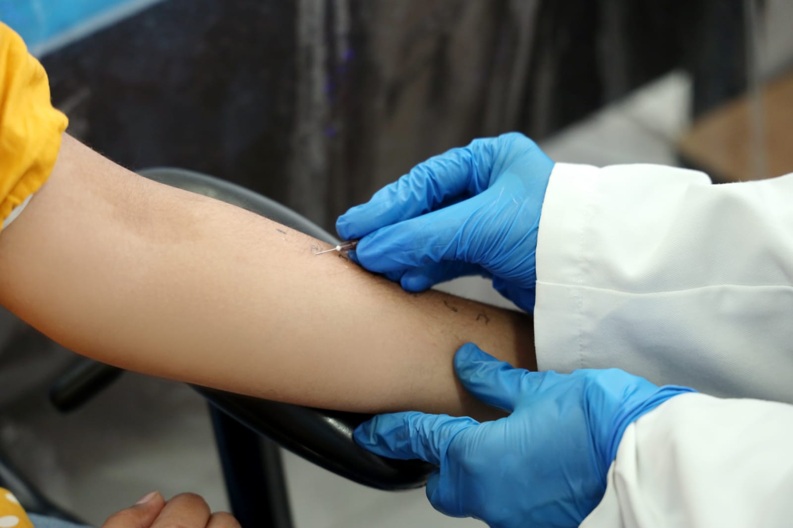Skin prick allergy testing at our Gurugram clinic