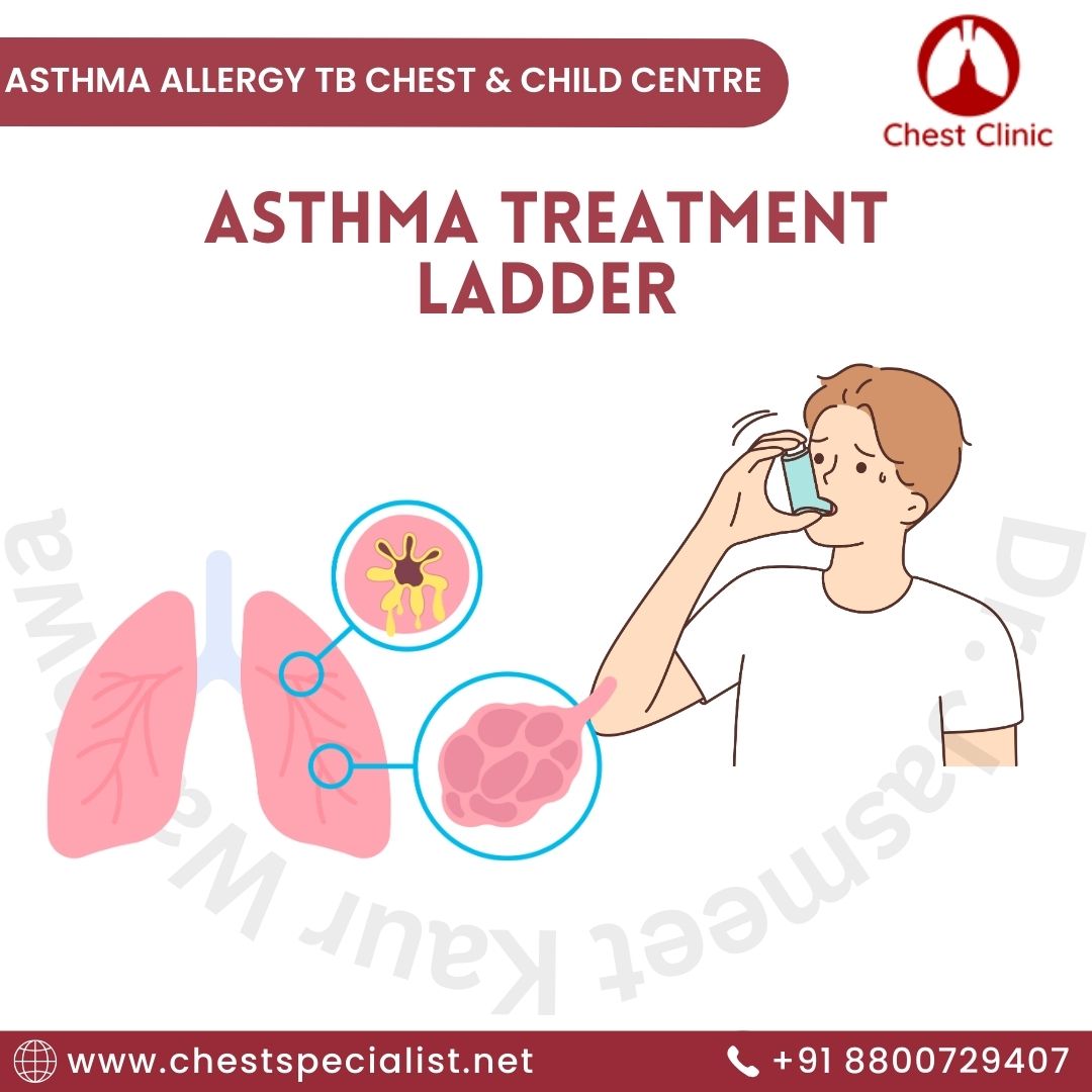 The Asthma Treatment Ladder for Children - Chest Specialist