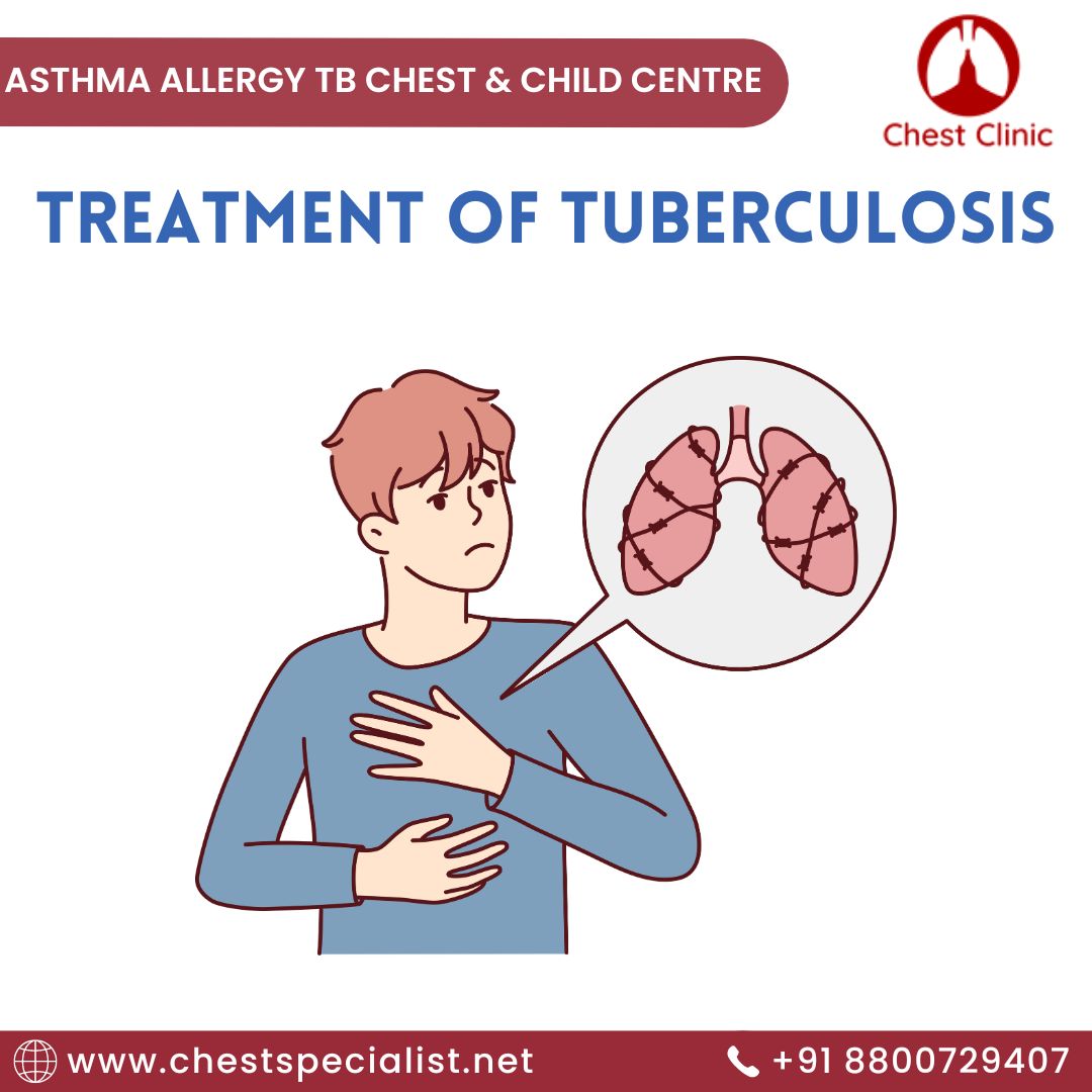 Treatment of tuberculosis