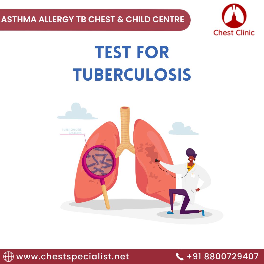 Treatment of Tuberculosis