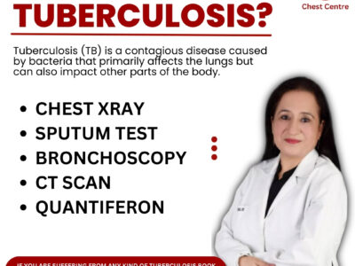 Test for Tuberculosis | Chest Clinic